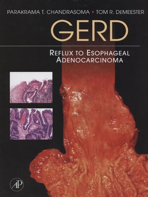 cover image of GERD